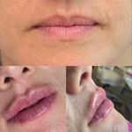 کلینیک زیبایی ژاله