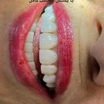 دندانپزشکی دکتر آزاده خلجیان