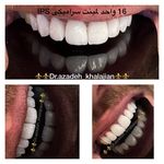 دندانپزشکی دکتر آزاده خلجیان