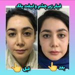 مزکز زیبایی لیا