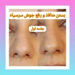 مزکز زیبایی لیا