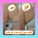 مزکز زیبایی لیا