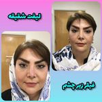 مزکز زیبایی لیا