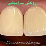 دندانپزشکی دکتر آزاده خلجیان