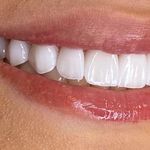 دندانپزشکی دکتر آزاده خلجیان