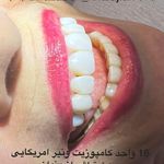 دندانپزشکی دکتر آزاده خلجیان