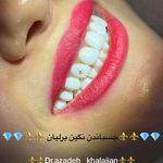 دندانپزشکی دکتر آزاده خلجیان