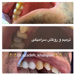 دندانپزشکی دکتر آزاده خلجیان