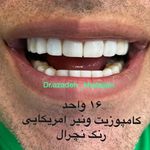 دندانپزشکی دکتر آزاده خلجیان