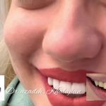 دندانپزشکی دکتر آزاده خلجیان