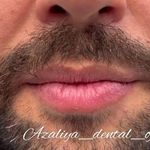 دندانپزشکی دکتر آزاده خلجیان