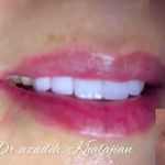 دندانپزشکی دکتر آزاده خلجیان