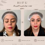 مرکز لیزر ،پوست و زیبایی کندی بیوتی