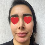 کلینیک لیزر و زیبایی دنیز