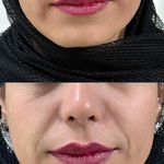 کلینیک زیبایی چشمه