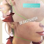 مطب دکتر علی دستخوش