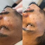 فیشال و پاکسازی تخصصی توسط پیراپزشک