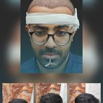 کلینیک زیبایی پوست و مو آتریسا