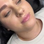 کلینیک زیبایی آزیتا آذر