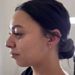 کلینیک زیبایی آزیتا آذر