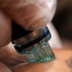 کلینیک زیبایی آزیتا آذر