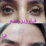 مطب پوست ،مو زیبایی دکتر فاطمه قره داغی