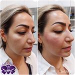 مطب پوست ،مو زیبایی دکتر فاطمه قره داغی