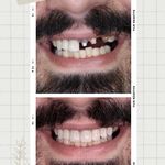 مرکز دندانپزشکی دیجیتال بابل ایمپلنت