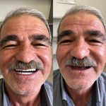 دندانسازی محلات (فتح المبین )