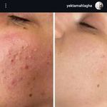تزریق ژل و بوتاکس یکتا