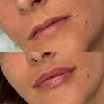 کلینیک پوست و مو و زیبایی هروی