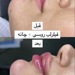 کلینیک پوست،مو،زیبایی،مرکز لیزر ‌پرنسا
