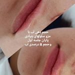 خدمات تخصصی ودرمانی با سلولهای بنیادی
