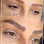 مرکز میکروبلیدینگ شیدینگ ریموو اسکالپ