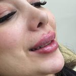 کلینیک زیبایی، پوست و لیزر(کندلا)  ظفر