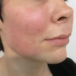 کلینیک زیبایی الماس کاملا اقساطی