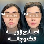 کلینیک زیبایی مانشید