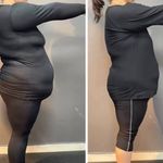 مرکز ایکس بادی پناهنده