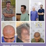 مرکز کاشت مو نیلوفر ( اندیمشک و دزفول )