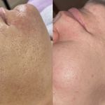 مرکز لیزر موهای زائد ماهور