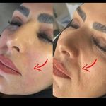 مرکز پوست و لیزر  سایناشور آمریکا دلدار