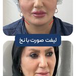 کلینیک زیبایی و جوانسازی پوست و مو الین