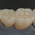 لابراتوار دندانسازی دیجیتال پرلادنت