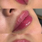 مطب پوست و مو و زیبایی دکتر سانیا صانعی