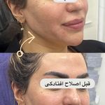 کلینیک لیزر و زیبایی صورت و بدن مینوسا