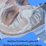 مرکز زیبایی ،پوست و لیزر زیبالیزا