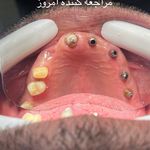 دندانپزشکی دیجیتال ونک دنتال
