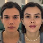 کلینیک زیبایی و لیزر دکتر آزاده اسماعیلی
