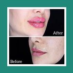مطب زیبایی و لیزر دکتر امیرحسین متوسلیان