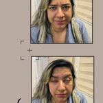 پزشک زیبایی ،پوست ،سوزنی ،اطفال حقایق